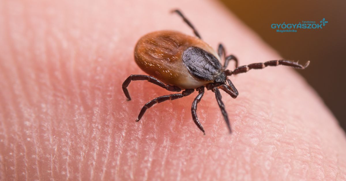 Jó hír a kirándulóknak - közel lehetünk a Lyme-kór elleni oltáshoz